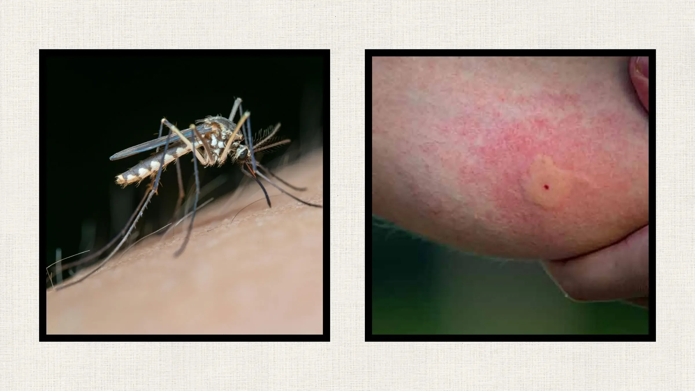The 10 Most Common Post-Hike Bug Bites and Rashes (and What They Look Like)